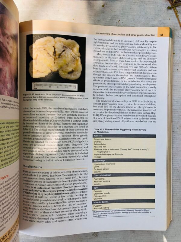 Robbins & Cotran Pathologic Basis of Disease (Robbins Pathology)